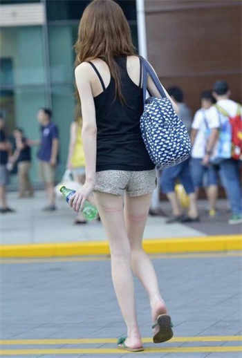 女人黑蘑菇是什么意思